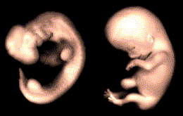 É constitucional pesquisar células-tronco a partir de embriões ?